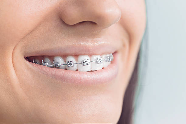 Best Wisdom Tooth Removal  in Sterling Ranch, CO